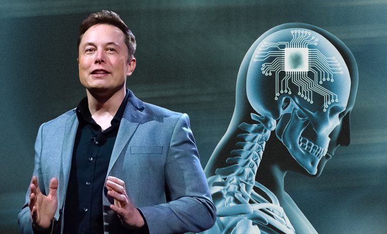 Neuralink